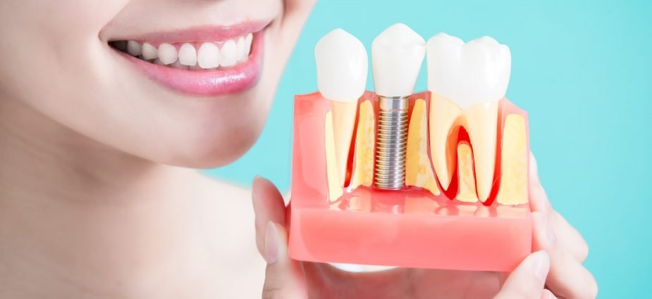 Dental Implants & Oral Surgery