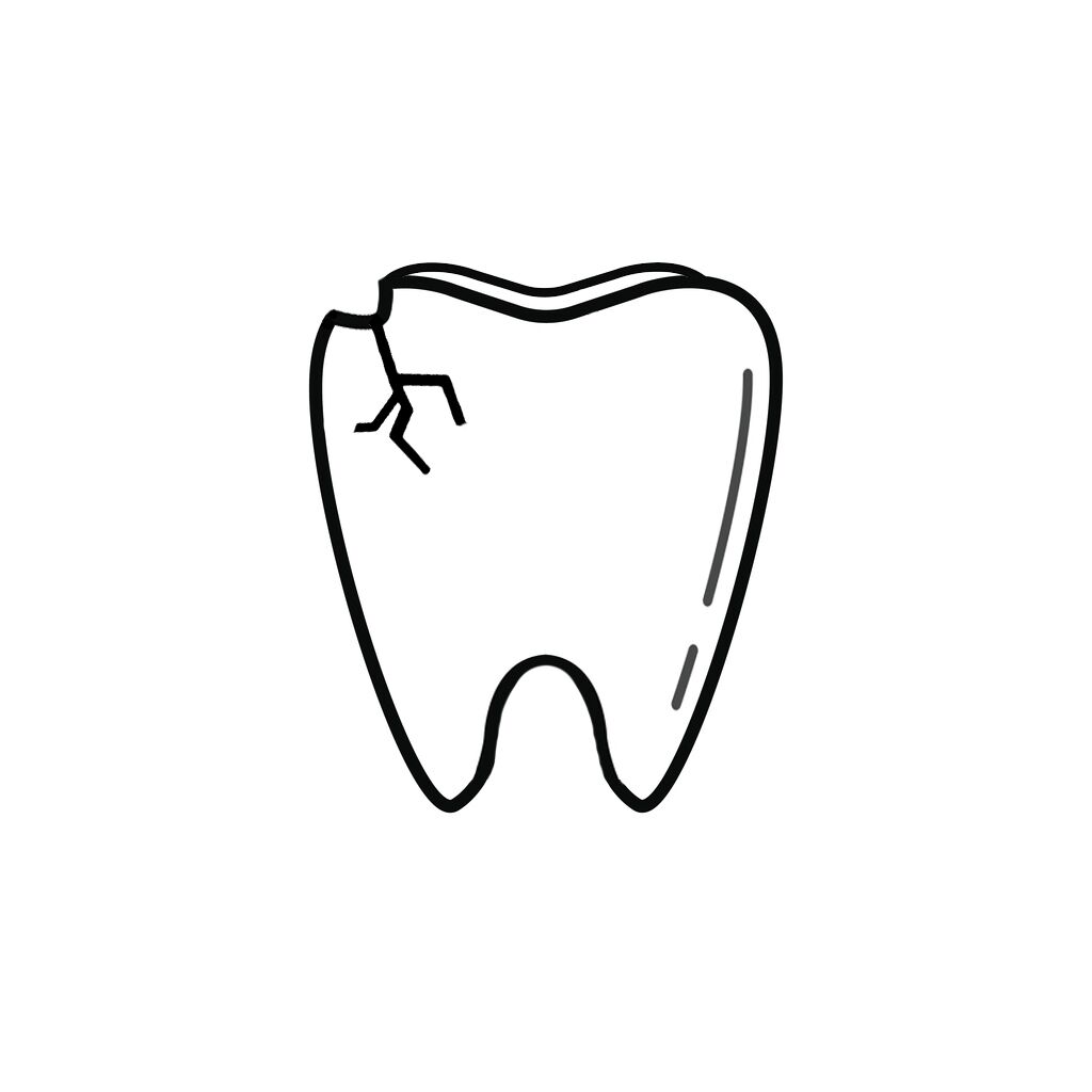 Houston TX Dentist | I Chipped a Tooth! What Can I Do?