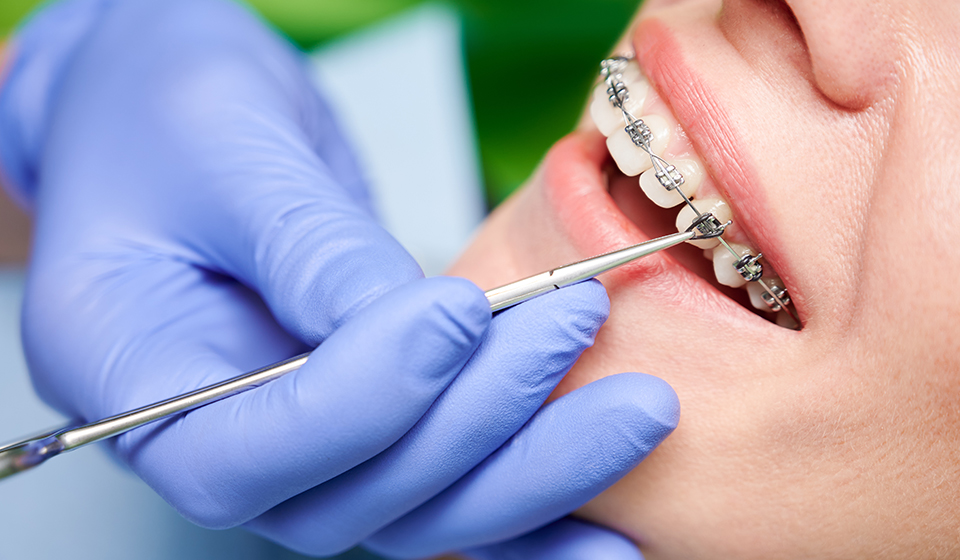 orthodontist in Westchase, Texas