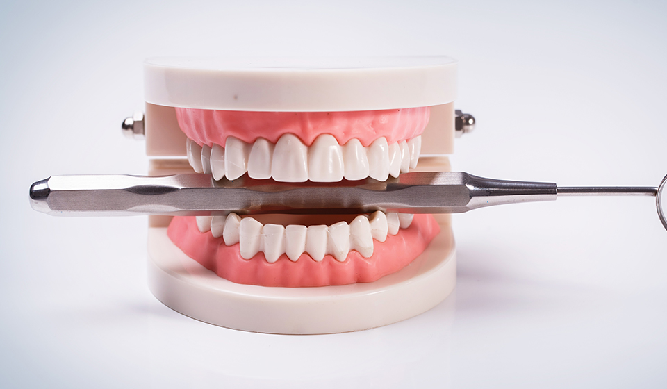 What Are Dentures And How To Care For Them