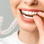 orthodontists in Westchase, TX