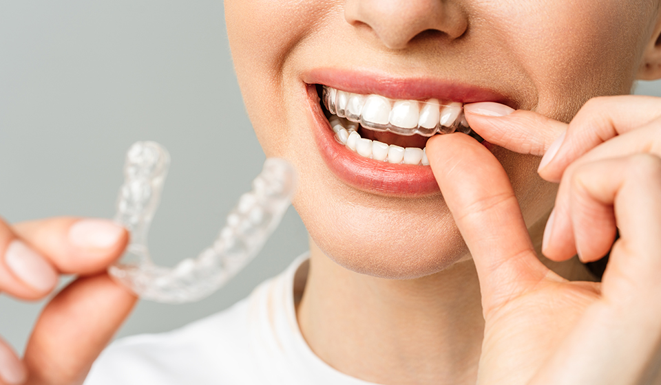 7 Types Of Bite Problems and Their Orthodontic Solutions