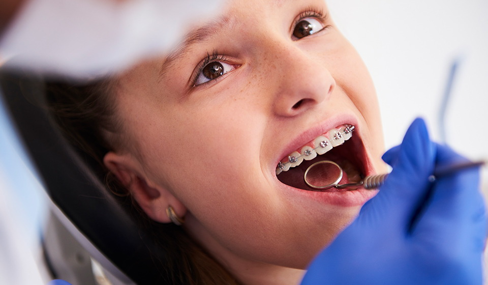 The Dental Braces Procedure: Treatment And Recovery