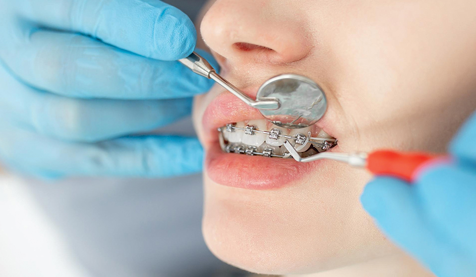 5 Signs You Might Need Orthodontic Services in Houston