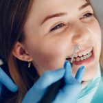 braces dentists in Westchase