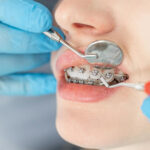 orthodontist in Houston