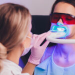 Teeth Whitening