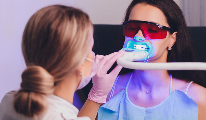 Teeth Whitening