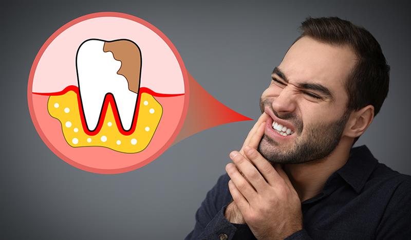 Gum Disease Treatment