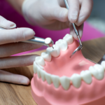 dental implants