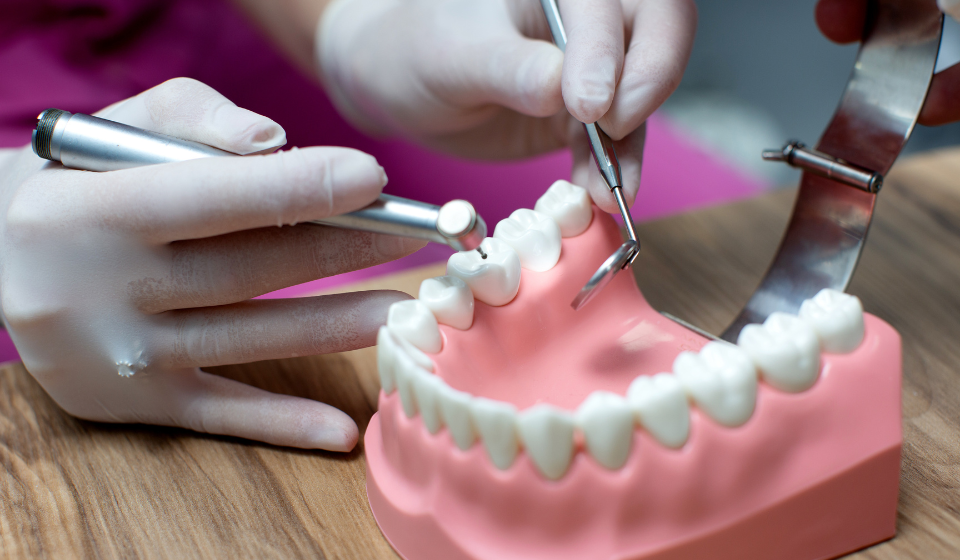 dental implants