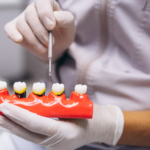 Dental Implants