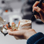 Dental implants