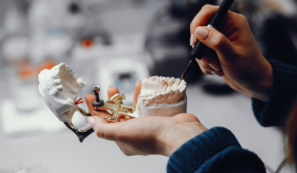 Dental implants