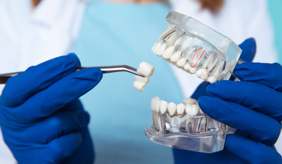What to Expect During and After a Dental Crown Procedure